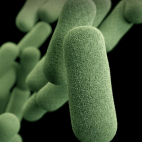 Haemophilus influenzae (CDC, public domain)